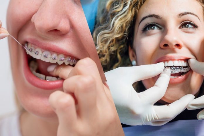 Invisalign i7 Invisalign i7